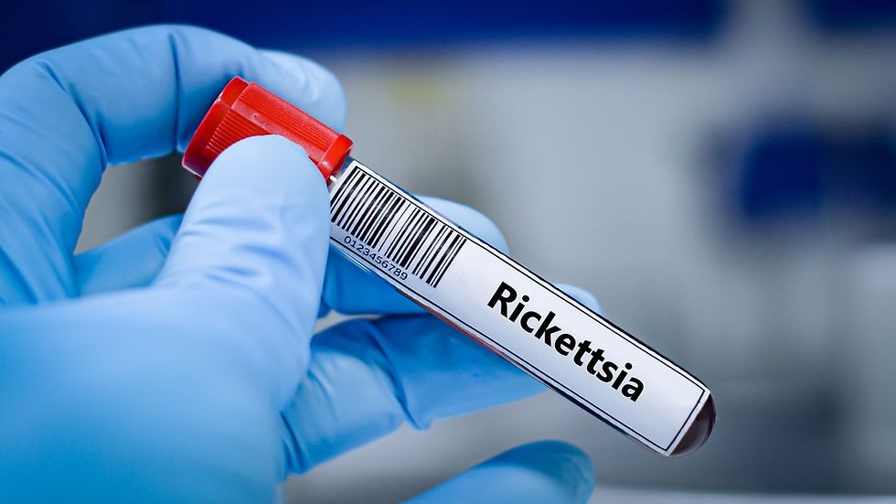 SFG Rickettsia DFA